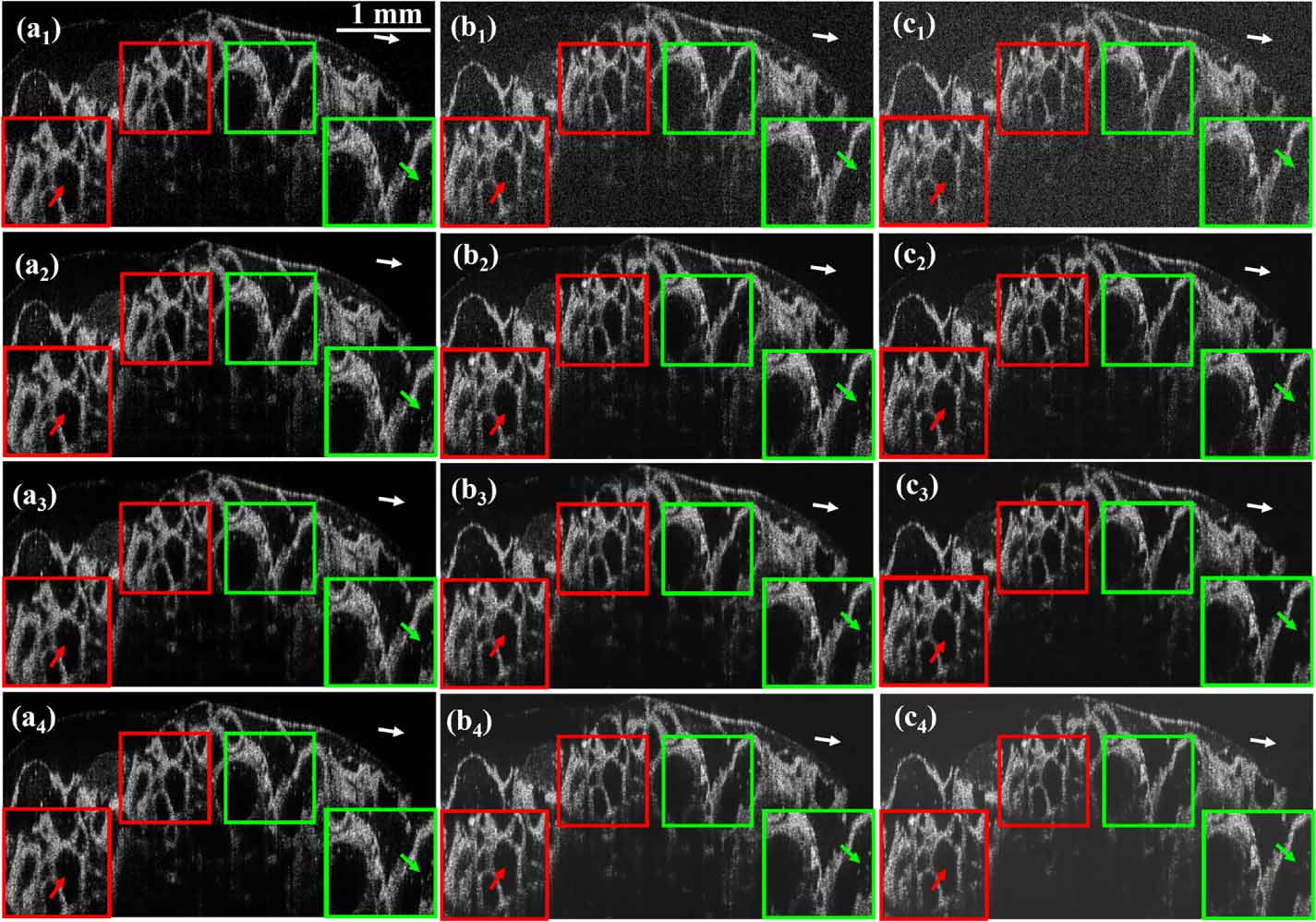 Deep learning generalization study on optical coherence tomography ...