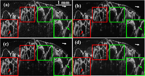 Deep learning generalization study on optical coherence tomography ...