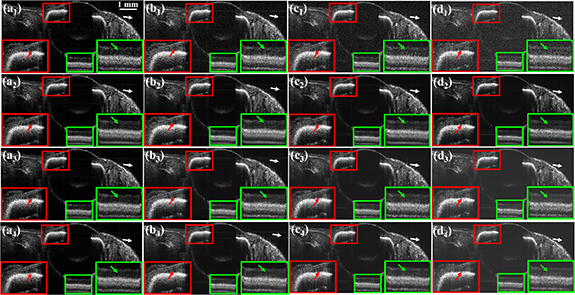 Deep learning generalization study on optical coherence tomography ...
