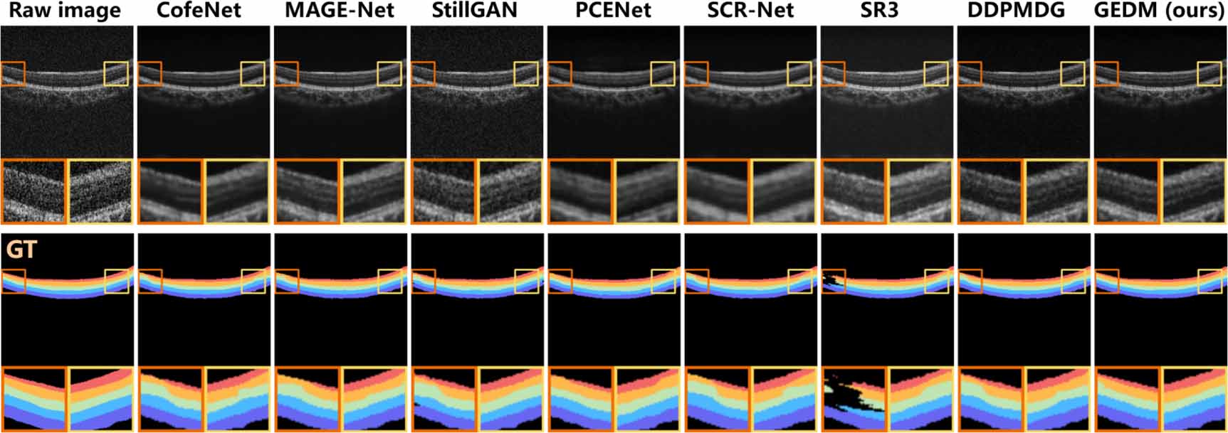 Medical Image Augmentation Generalizable medical image enhancement using structure-preserved ...