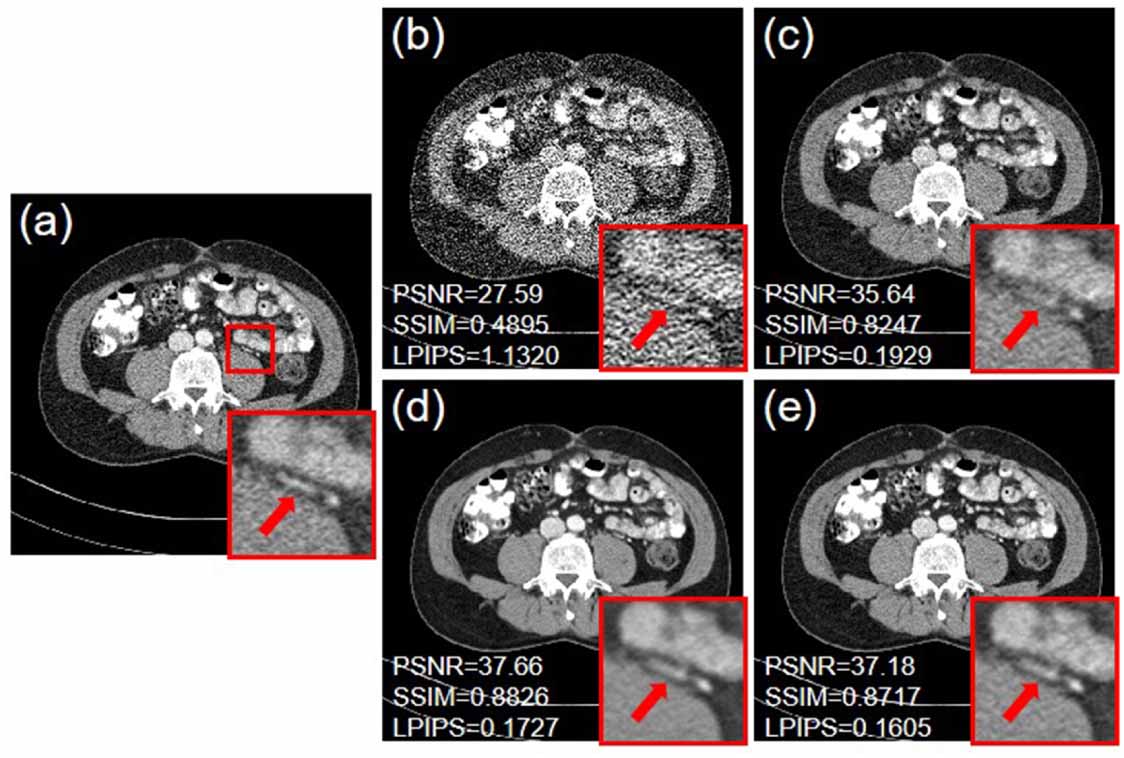 Dose-aware denoising diffusion model for low-dose CT - IOPscience