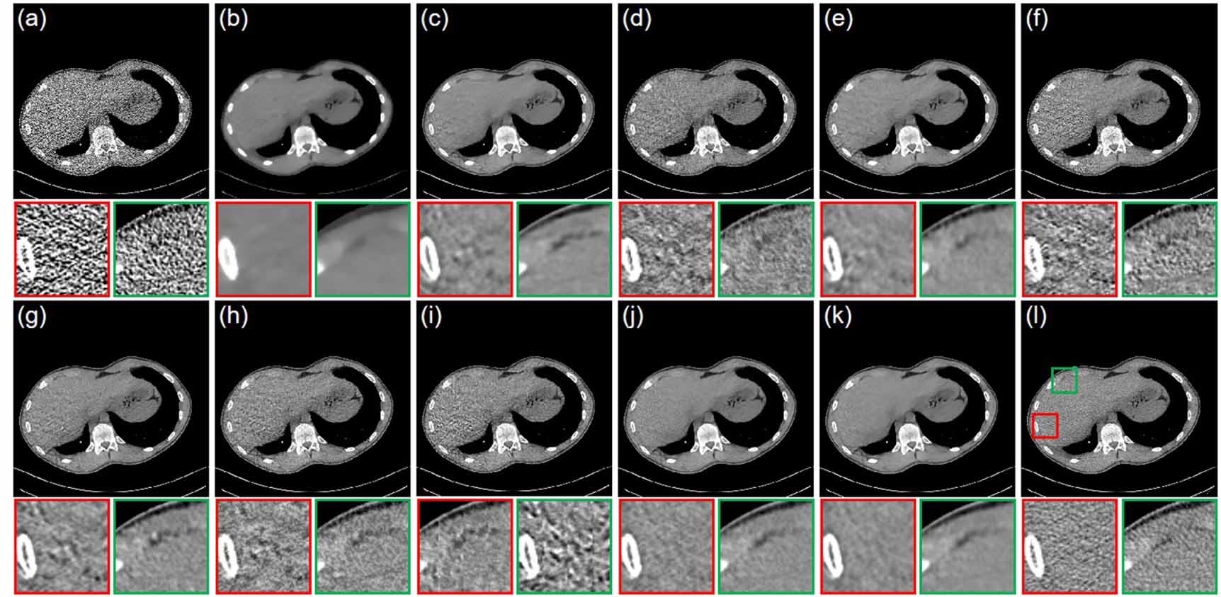 Dose-aware denoising diffusion model for low-dose CT - IOPscience