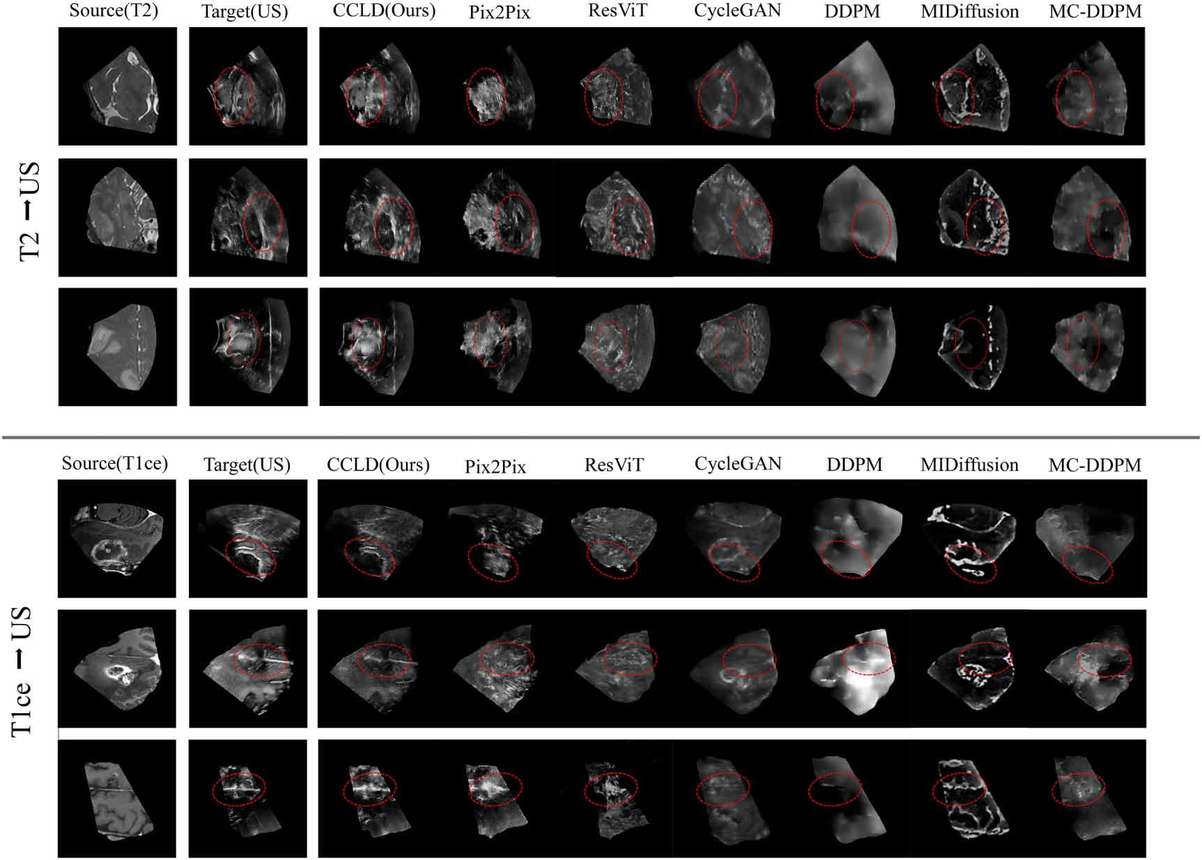 Cross-modal conditional latent diffusion model for brain MRI to ...