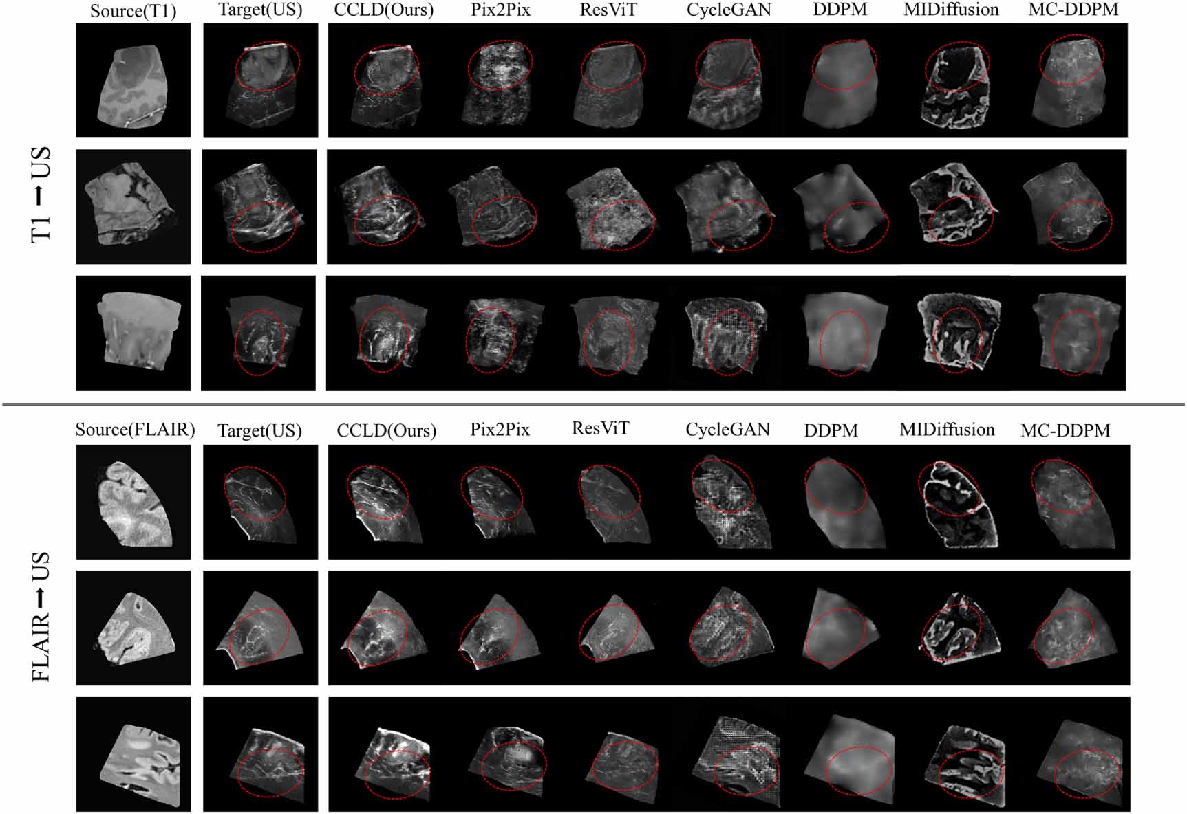 Cross-modal conditional latent diffusion model for brain MRI to ...