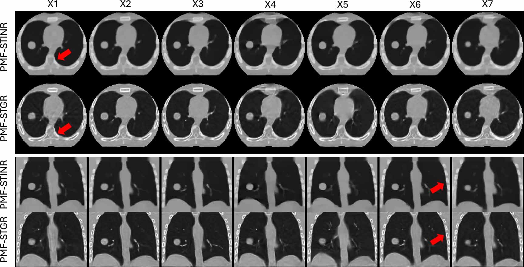 Time-resolved dynamic CBCT reconstruction using prior-model-free ...