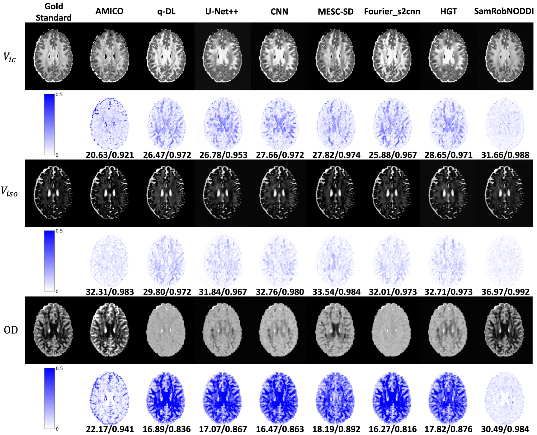 Noddi Preprocessing SamRobNODDI: q-space sampling-augmented continuous representation ...