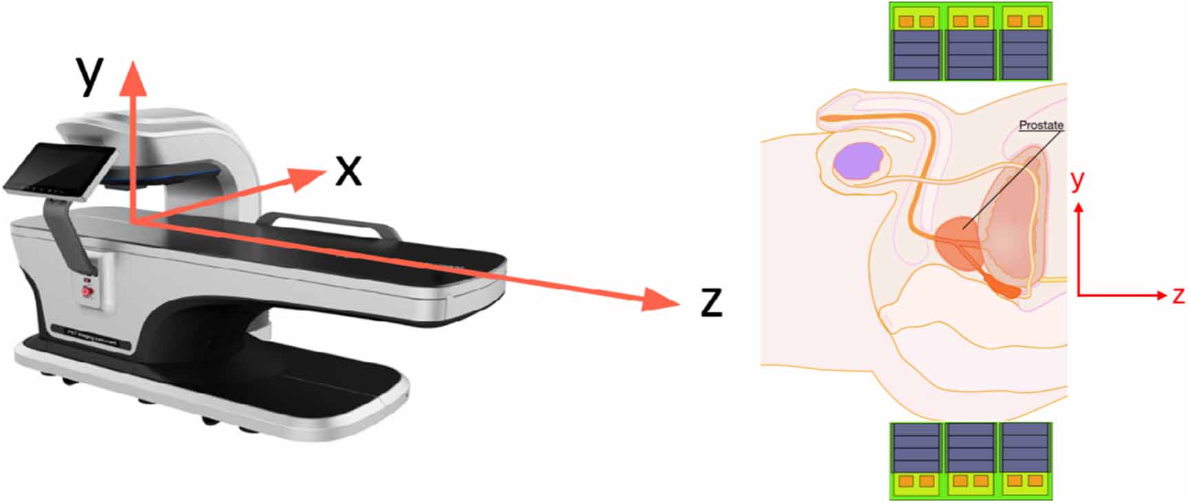 Dedicated prostate DOI-TOF-PET based on the ProVision detection concept ...