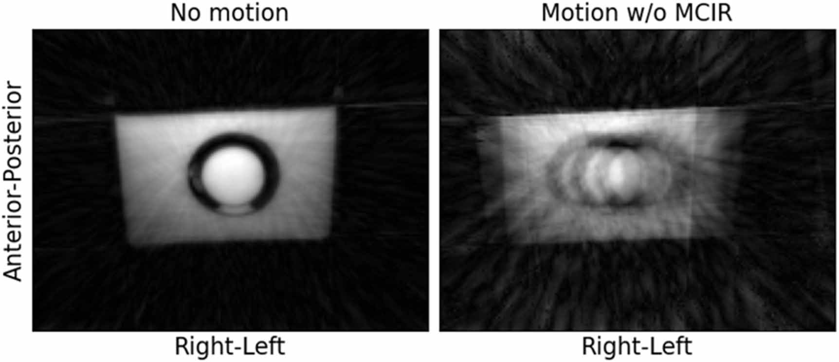 Efficient motion-corrected image reconstruction for 3D cardiac MRI ...