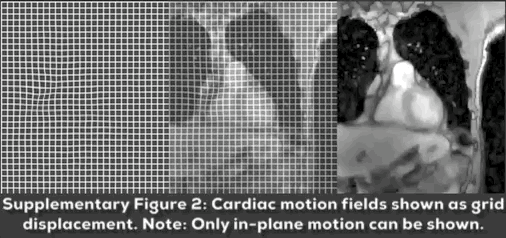 Supplementary data for: Efficient motion-corrected image reconstruction ...
