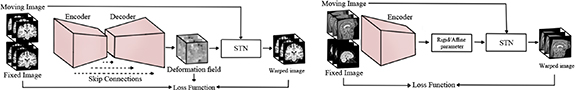 Unsupervised deep learning-based medical image registration: a survey ...