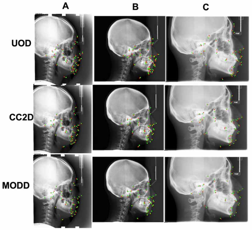MODD: multicenter one-shot medical landmark detection and denoising ...