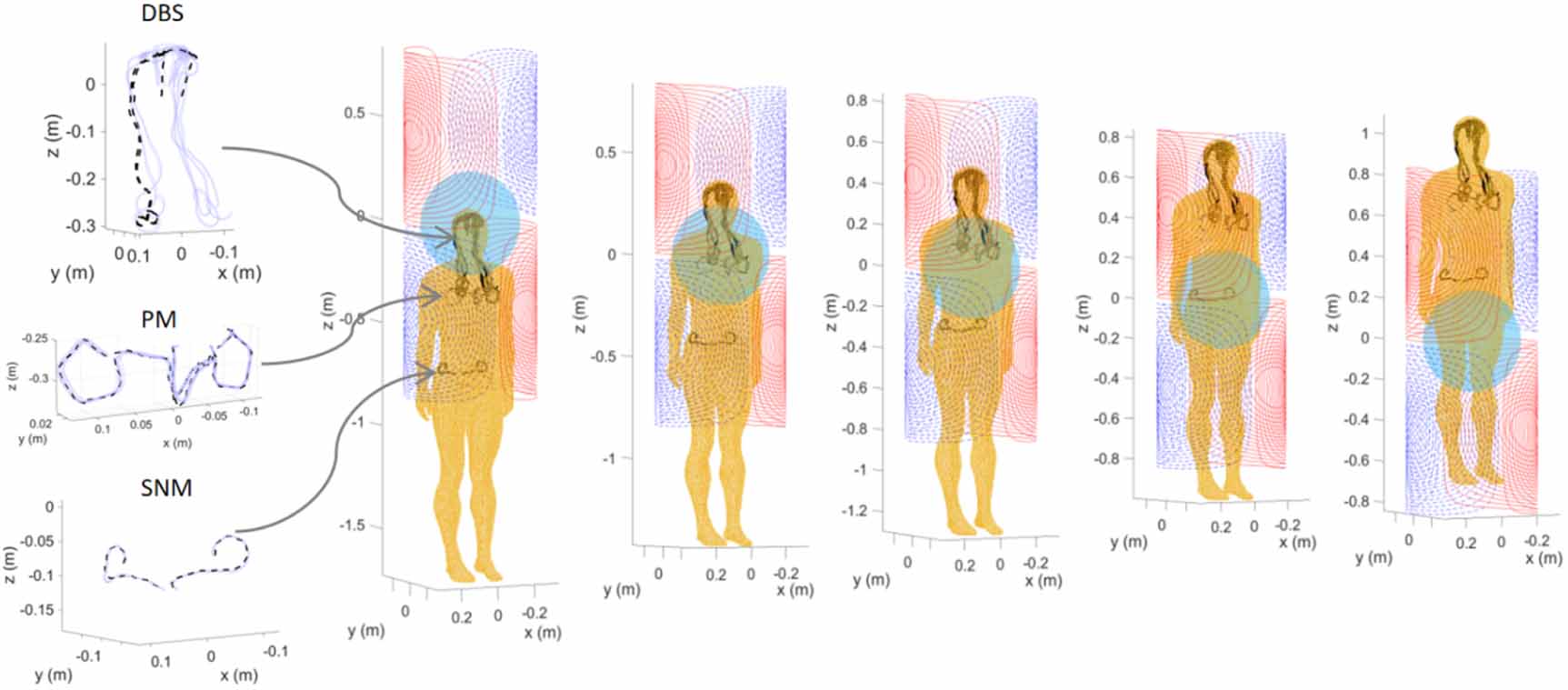 Multifactorial analysis of MRI gradient safety for active implantable ...