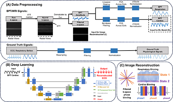 Deep learning-driven contactless ECG in MRI via beat pilot tone for ...