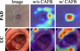 MPCNet: multi-scale decomposition network with perception weaving and ...