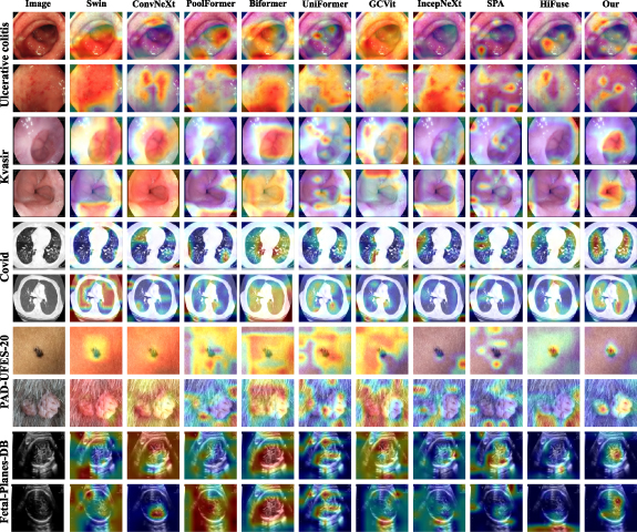 MPCNet: multi-scale decomposition network with perception weaving and ...