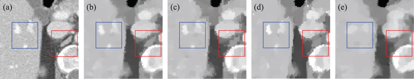 A springback TV algorithm for image reconstruction from sparse view ...