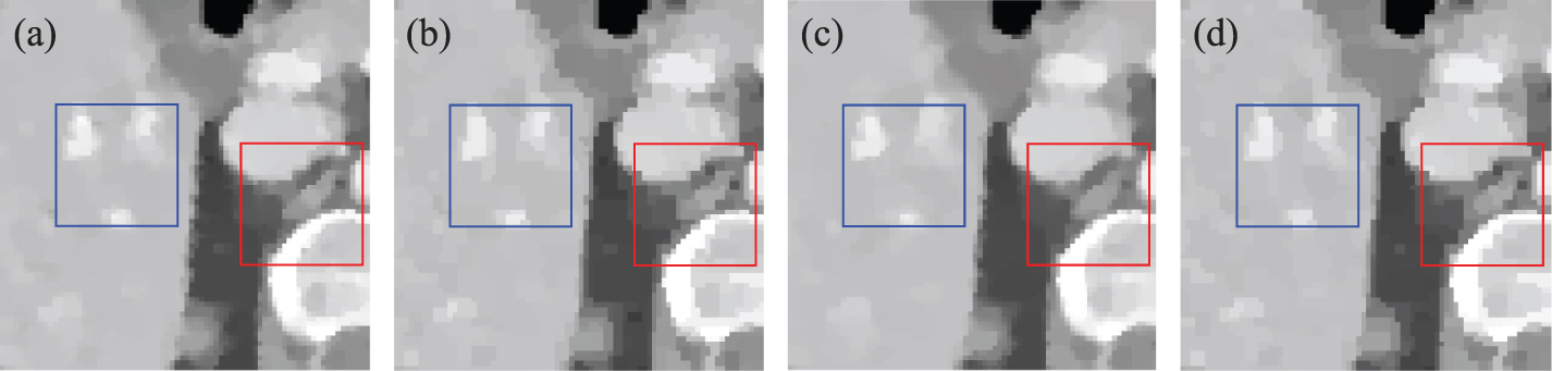 A springback TV algorithm for image reconstruction from sparse view ...