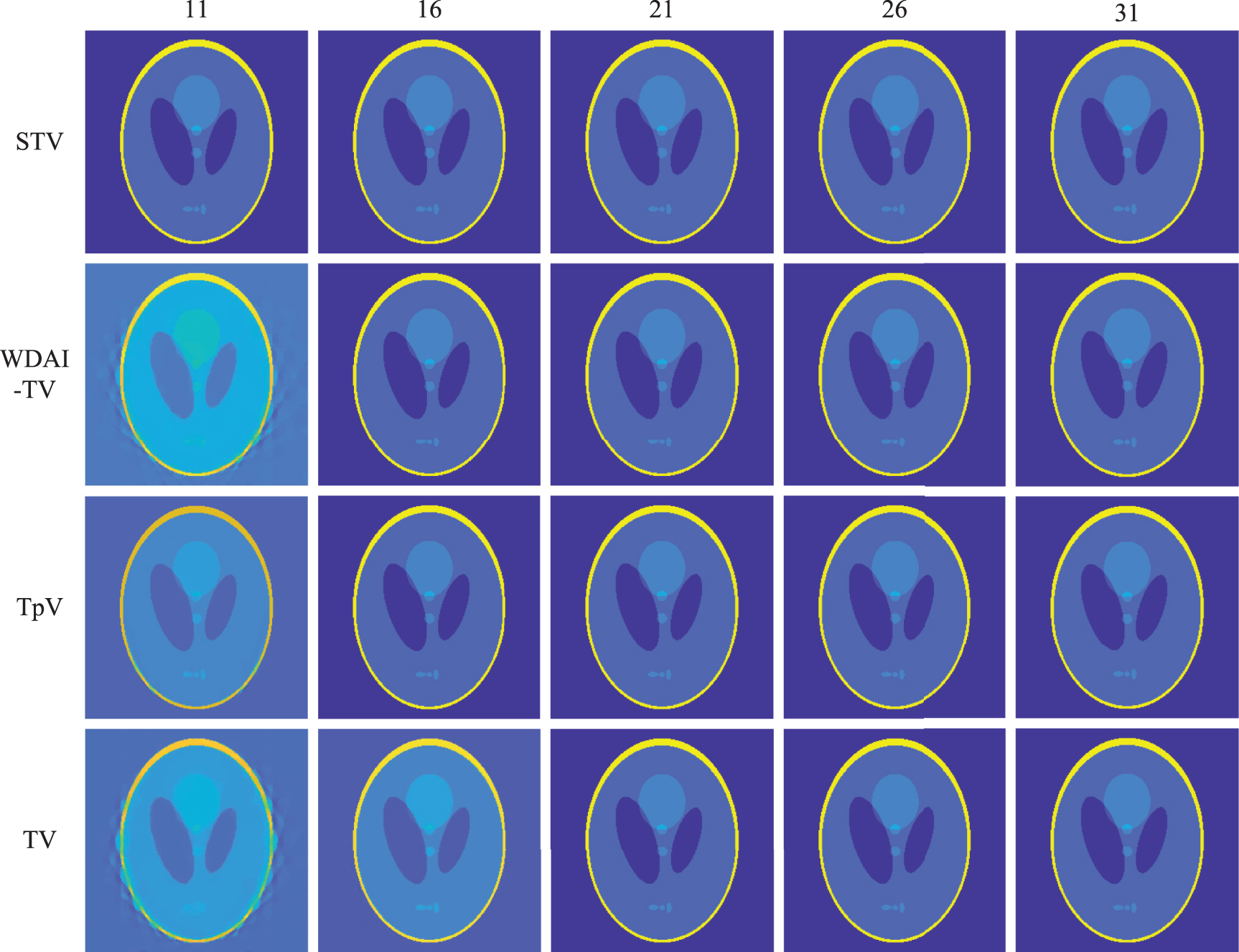 A springback TV algorithm for image reconstruction from sparse view ...