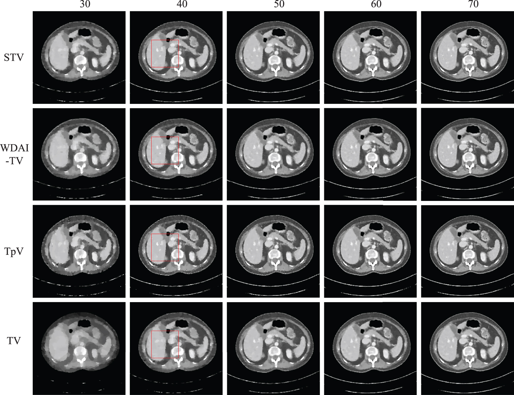 A springback TV algorithm for image reconstruction from sparse view ...