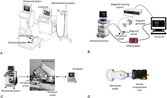 Sonogram Types Three-dimensional ultrasound imaging: a review of the technology ...