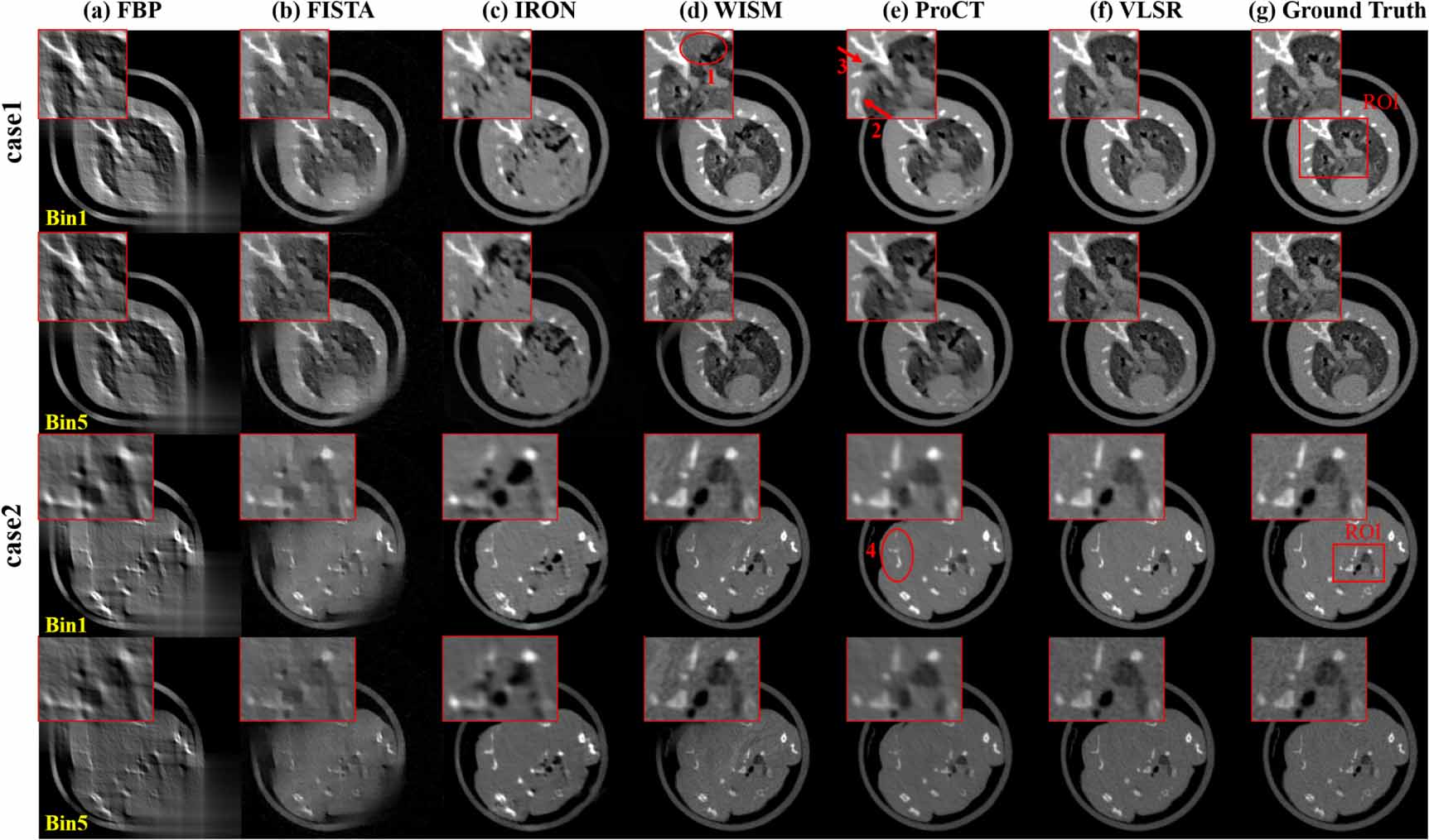 Visual language model-assisted spectral CT reconstruction by diffusion ...