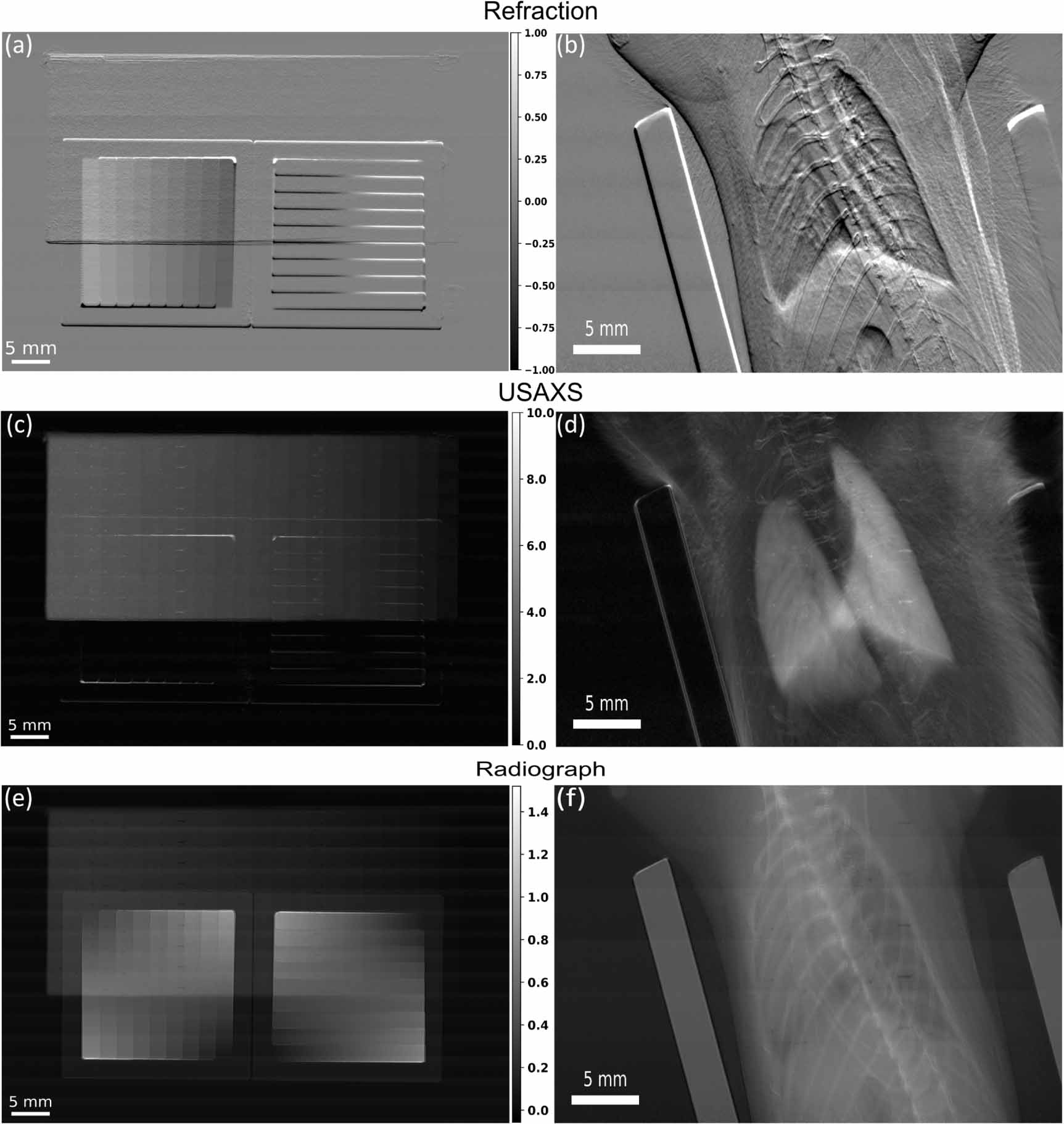 A Gaussian fitting-based analysis method for multiple image radiography ...