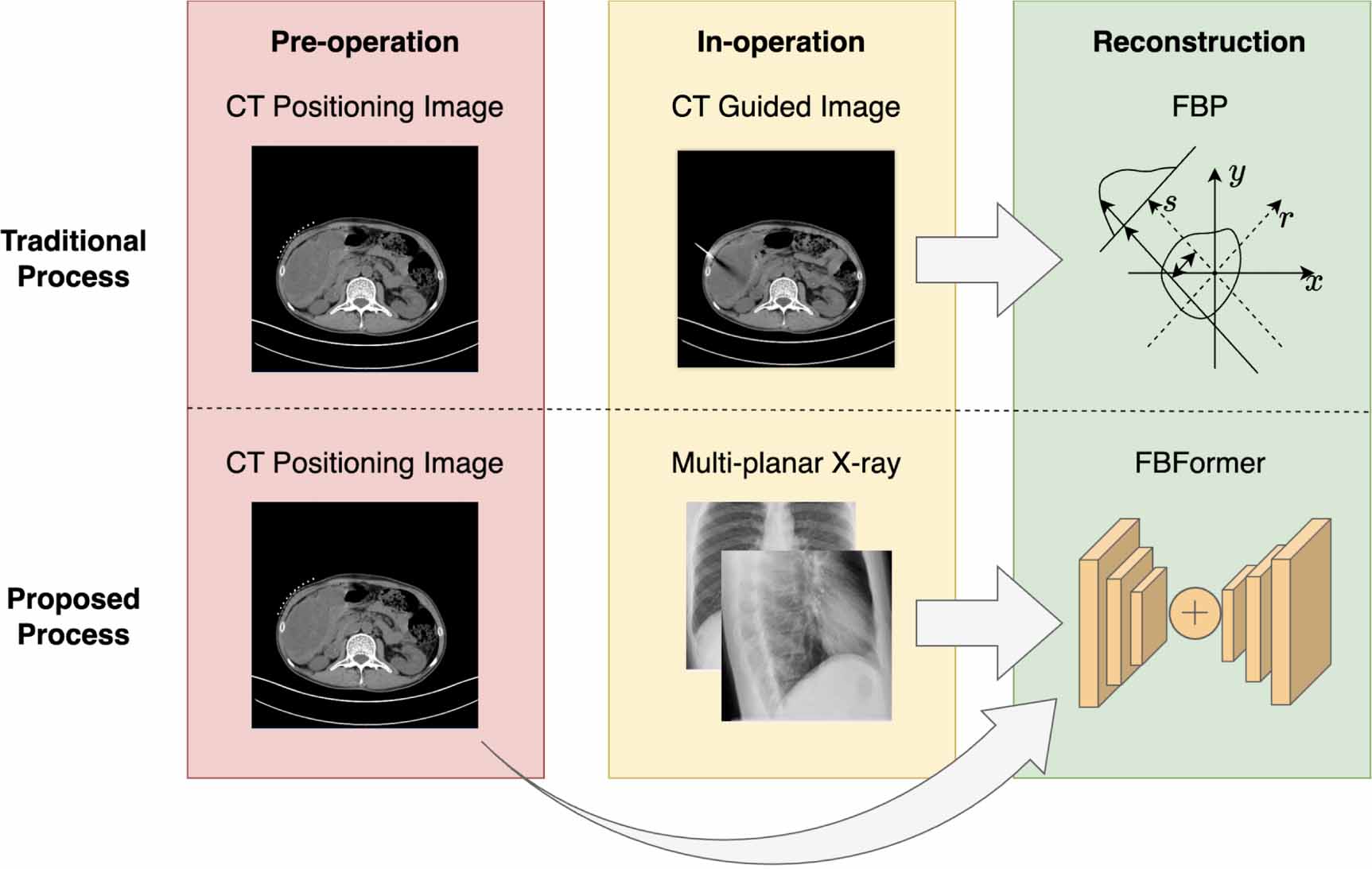 FBFormer: interventional ultra-sparse CT reconstruction with image ...