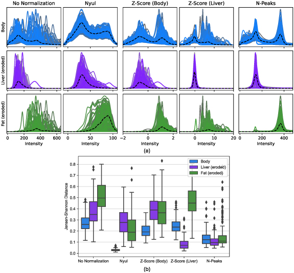 N-Peaks: MRI intensity normalization based on normal tissue histogram ...