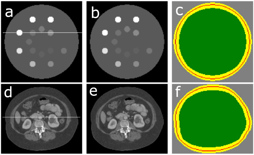 Accurate image reconstruction within and beyond the field-of-view of CT ...