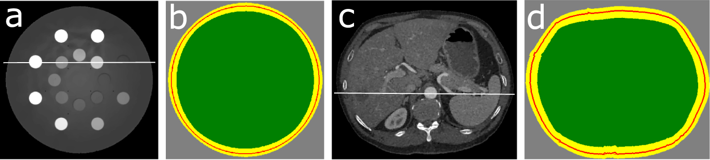Accurate image reconstruction within and beyond the field-of-view of CT ...