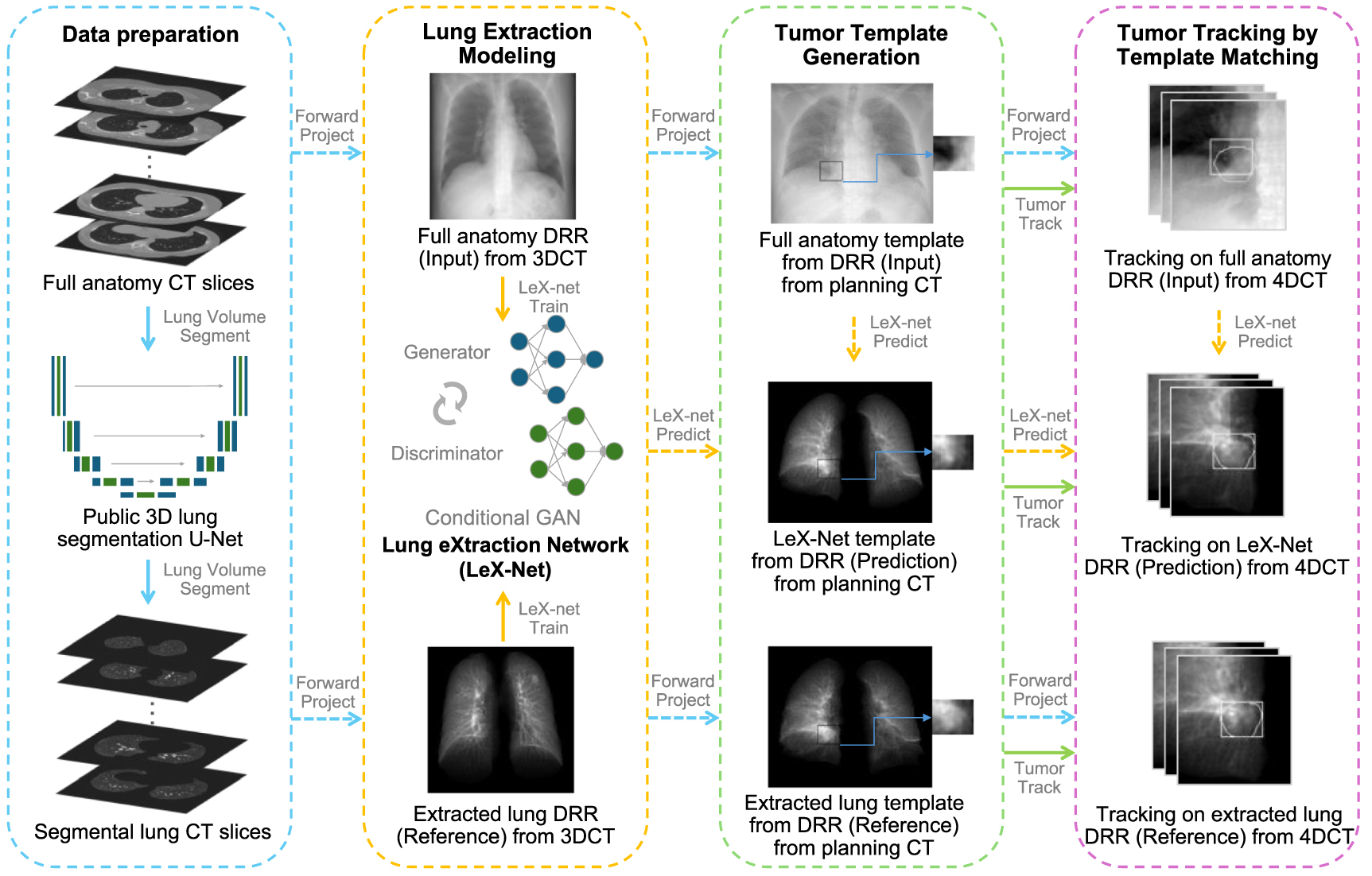 Real-time lung extraction from synthesized x-rays improves pulmonary ...