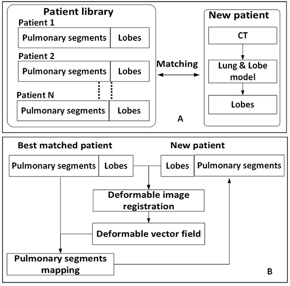 Anatomy-wise lung ventilation imaging for precise functional lung ...