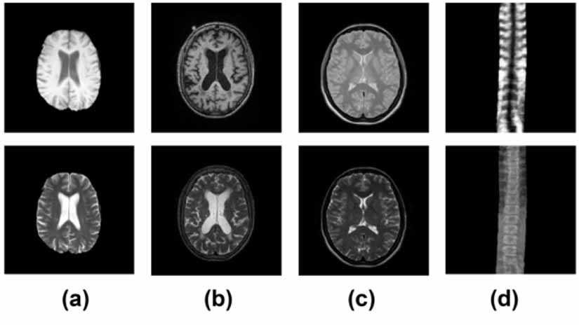 CycleH-CUT: an unsupervised medical image translation method based on ...