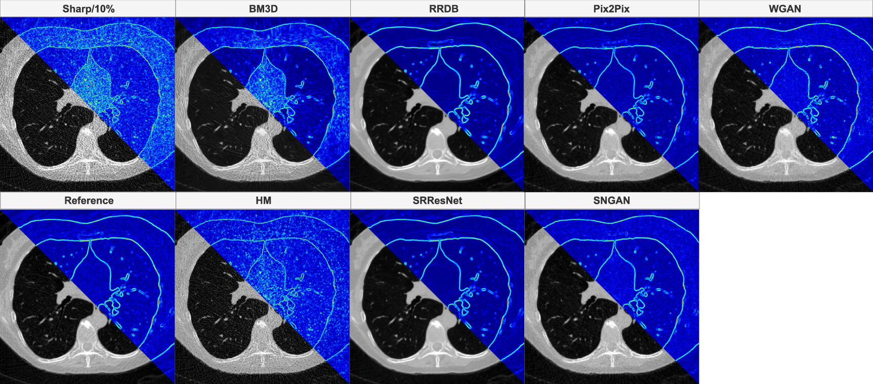 A comparative analysis of image harmonization techniques in mitigating ...