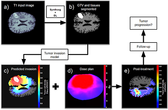 Role of modeled high-grade glioma cell invasion and survival on the ...