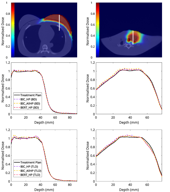 Validation of Monte Carlo simulations with measurement data for fetal ...