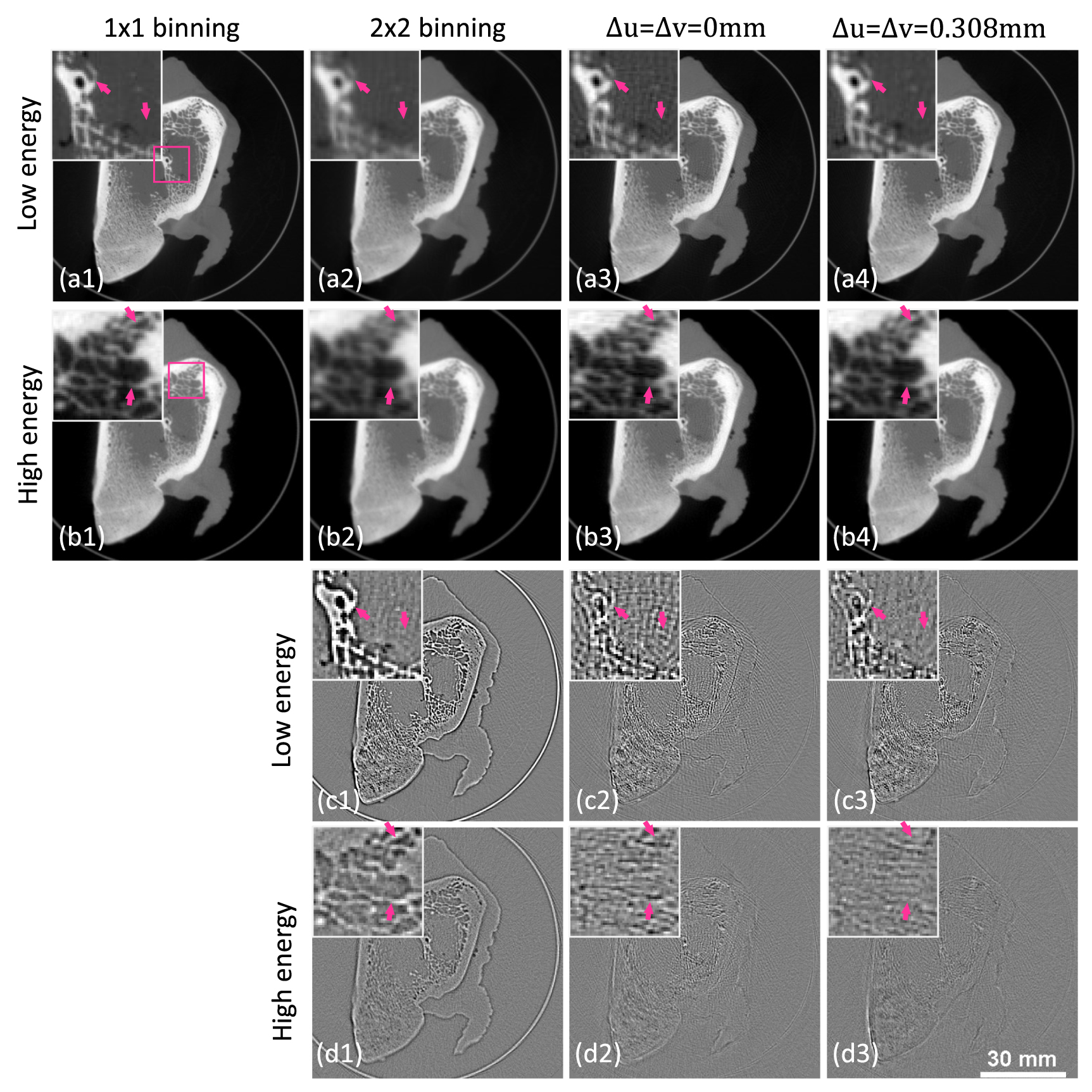 Cbct Resolution Near-isotropic super-resolution CBCT imaging with a dual-layer flat ...