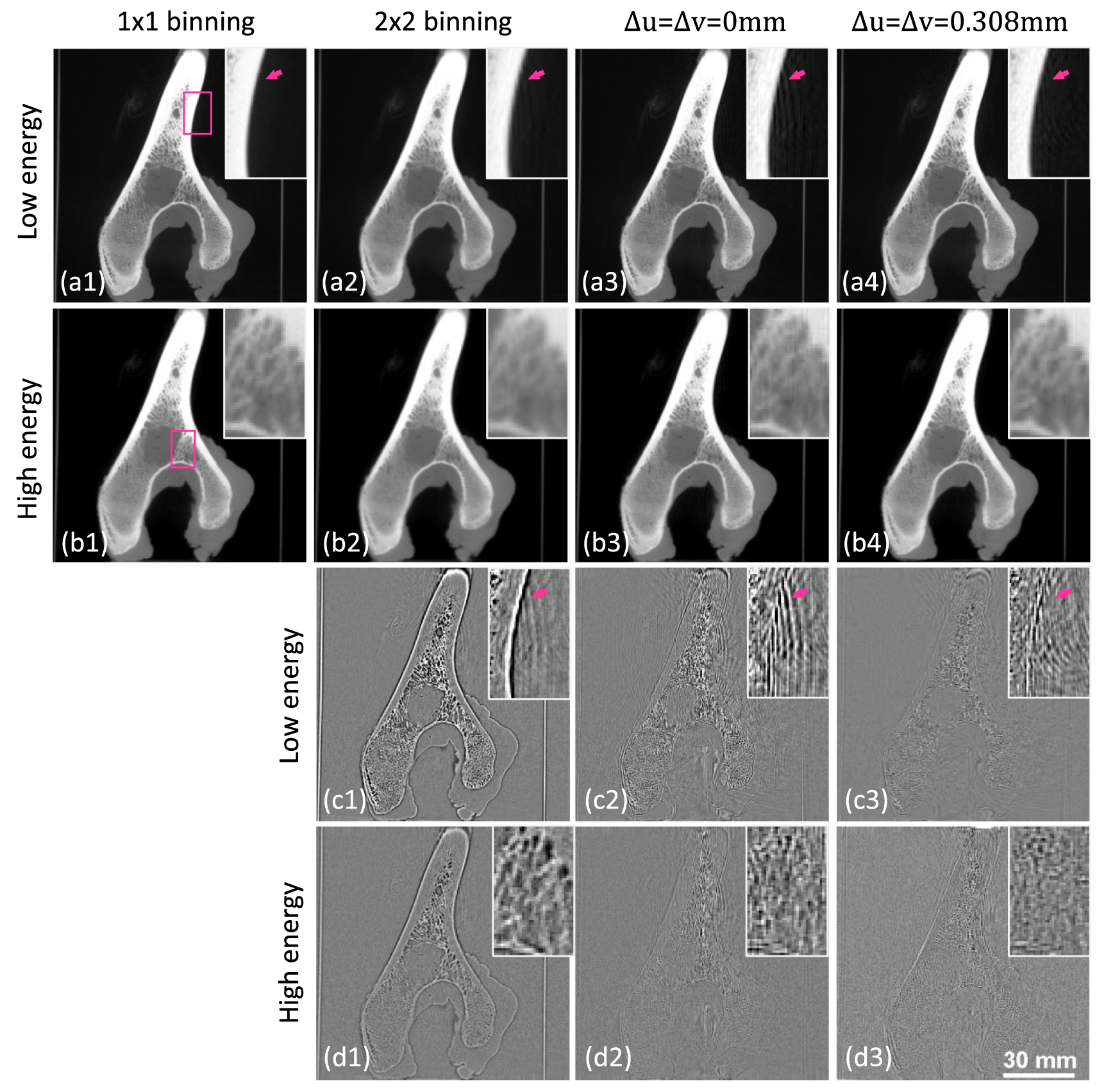 Cbct Resolution Near-isotropic super-resolution CBCT imaging with a dual-layer flat ...