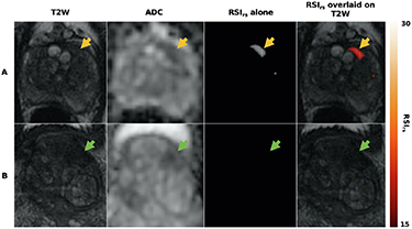 The role of diffusion-weighted MRI in biological image-guided radiation ...