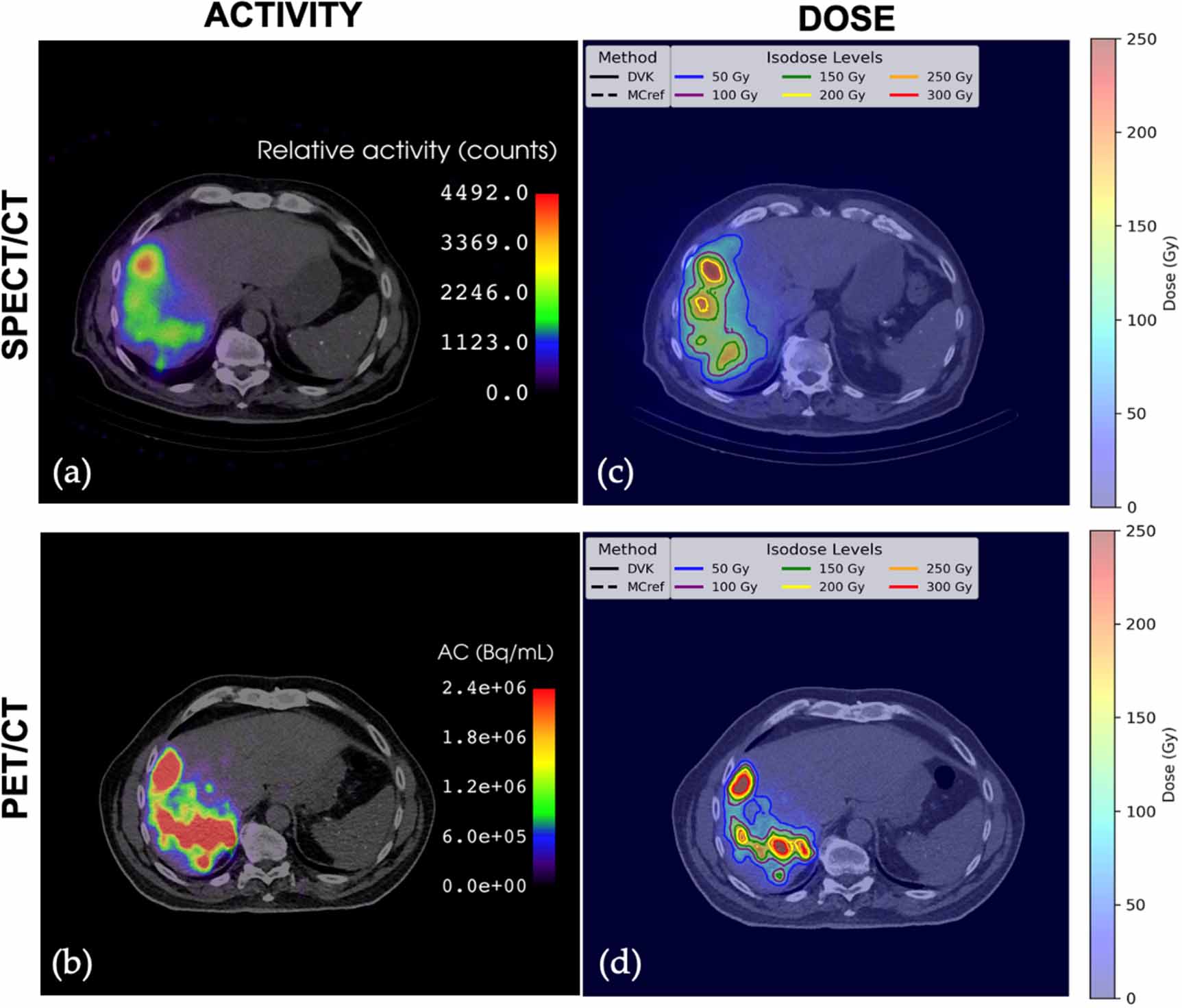 Integration of a dose-voxel kernel (DVK) convolution method for