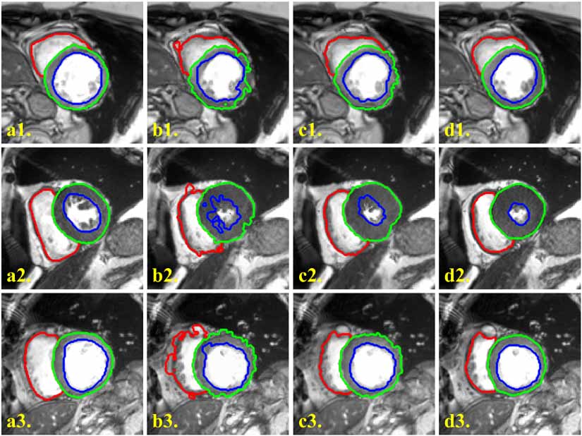 Foundation model-enhanced unsupervised 3D deformable medical image ...
