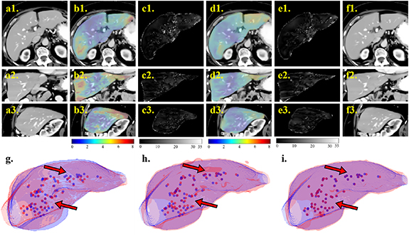 Foundation model-enhanced unsupervised 3D deformable medical image ...