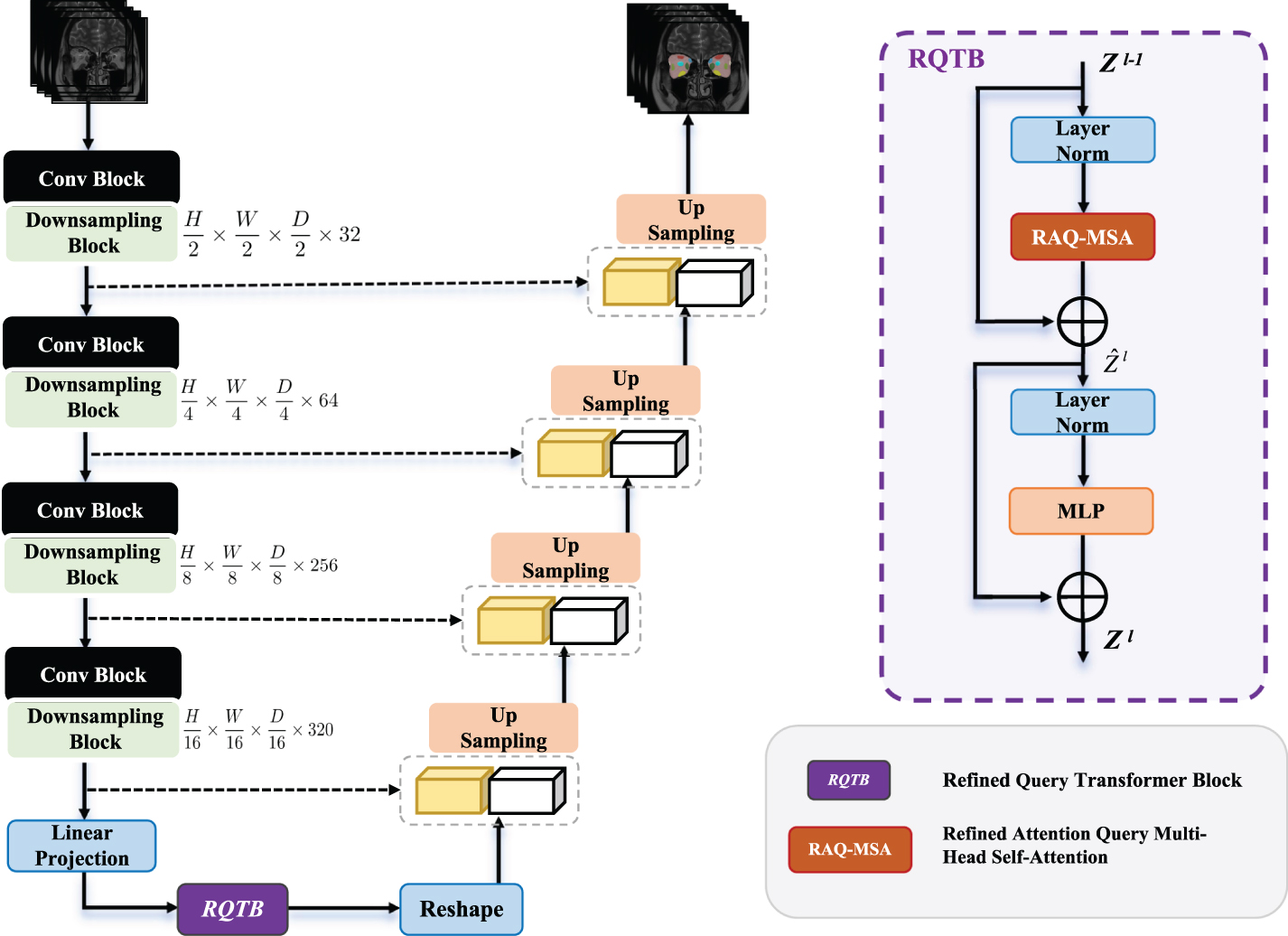 Refined query network (RQNet) for precise MRI segmentation and robust ...