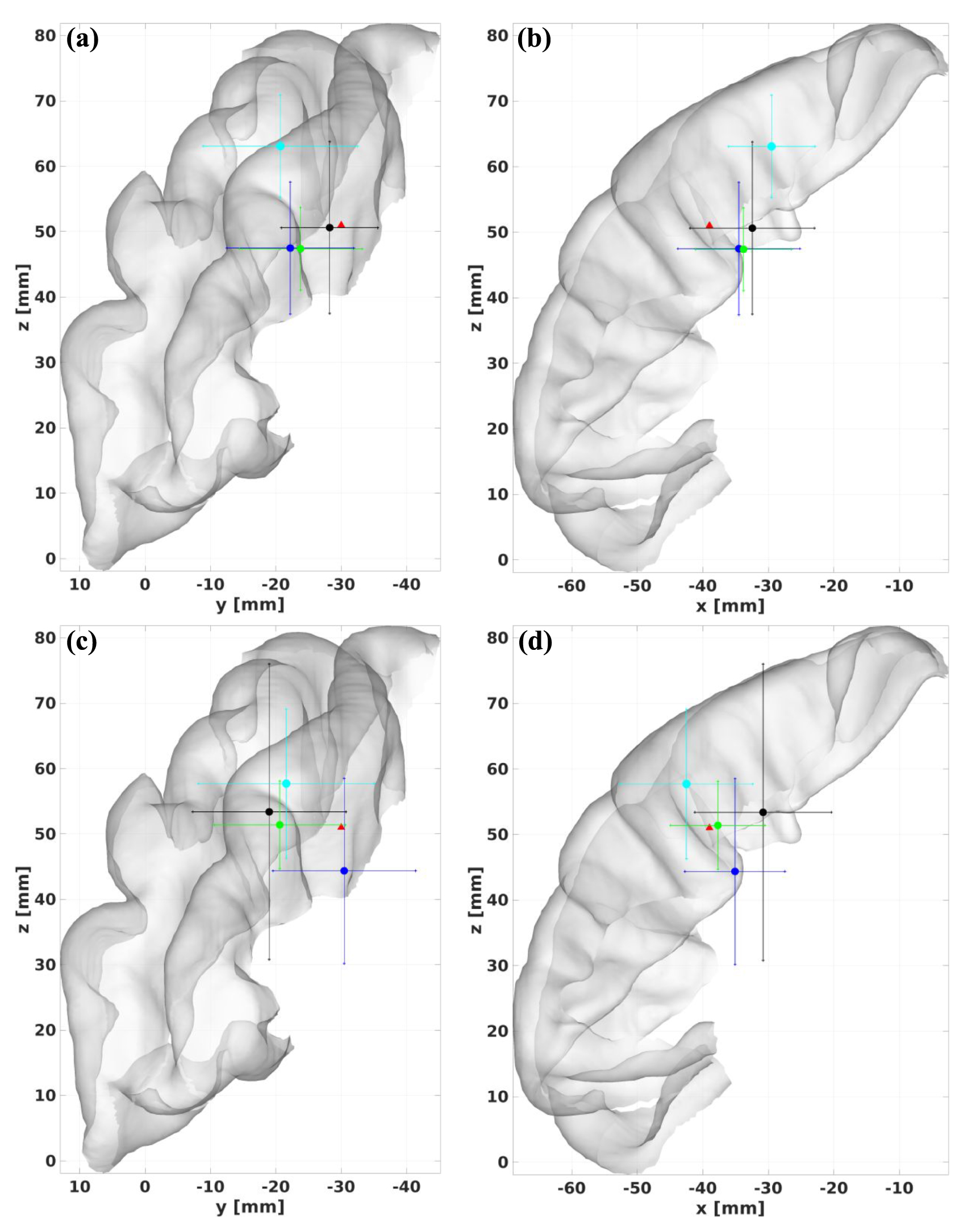 Influence of personalized human head modeling and resolution on EEG ...