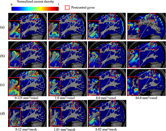 Influence of personalized human head modeling and resolution on EEG ...
