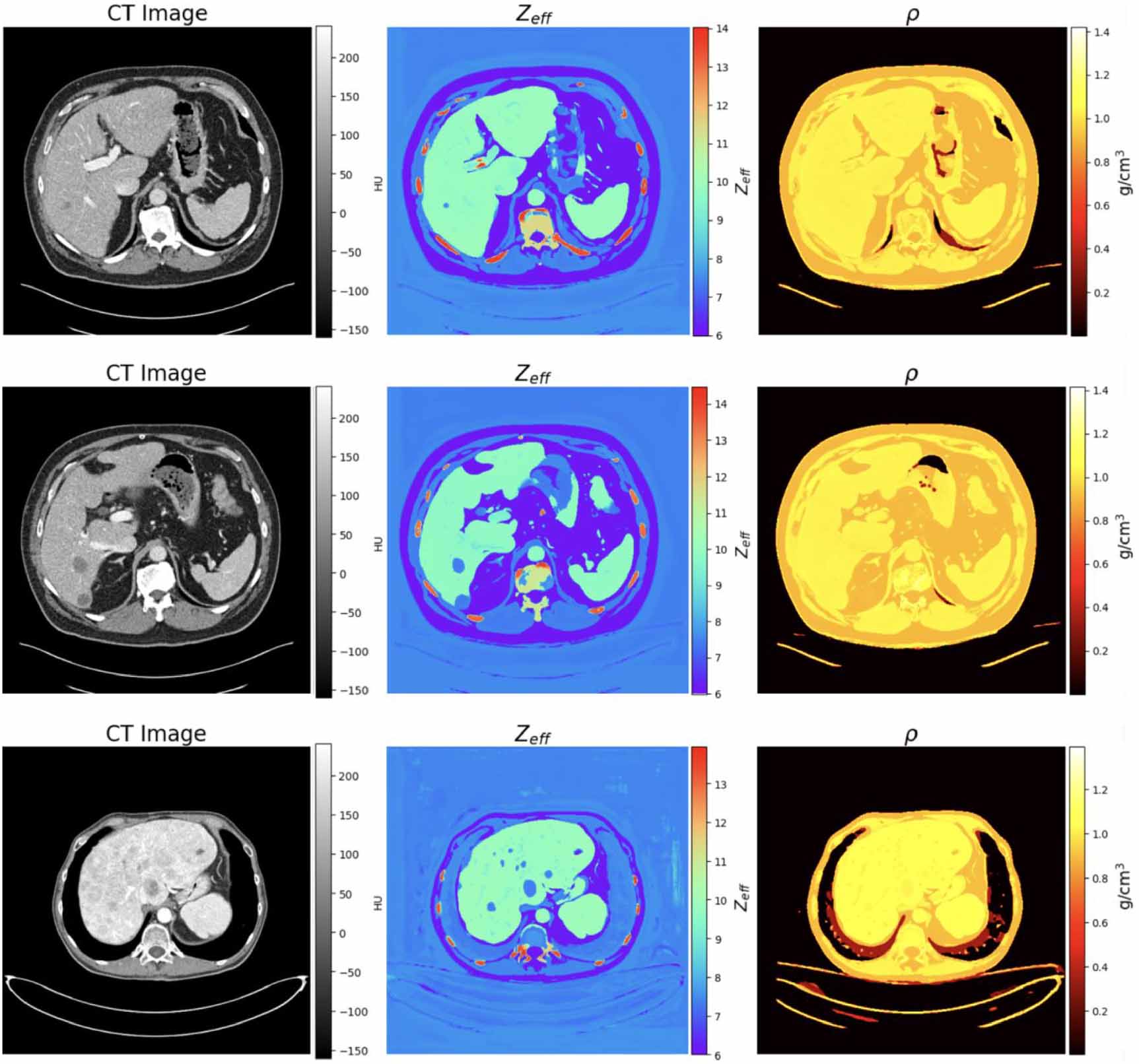 Ct Image Complex Example Truth-based physics informed estimation of material composition in ...