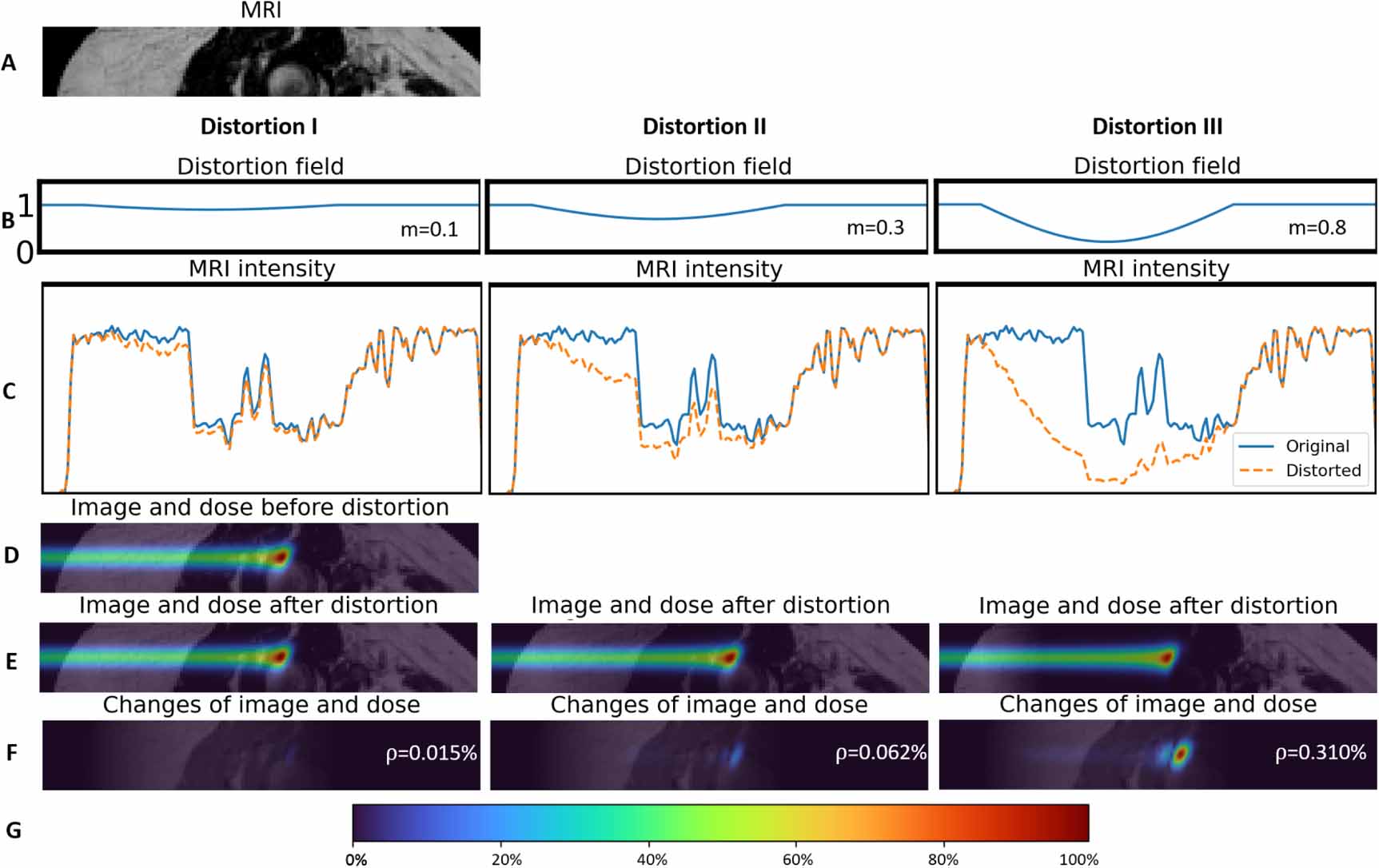 Magnetic resonance imaging-based proton dose calculation for pelvic ...