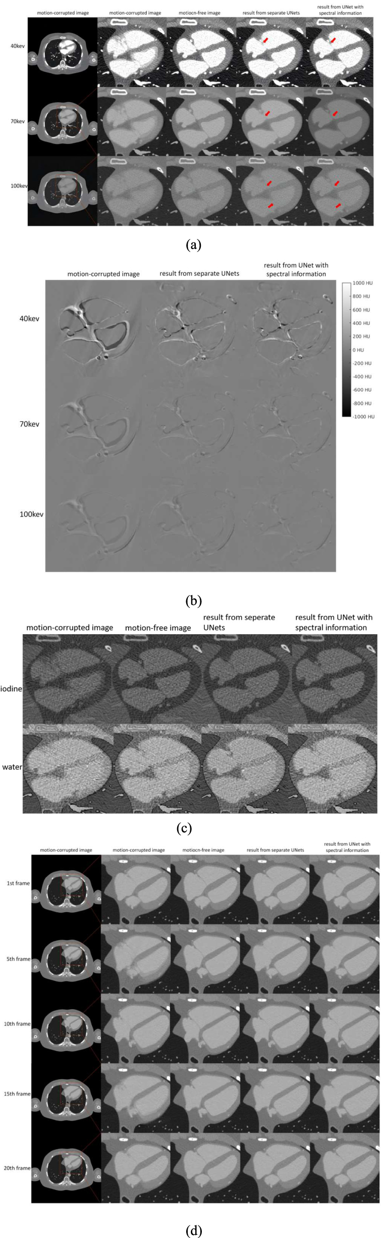 Deep-learning-based spectral motion artifact correction on photon ...