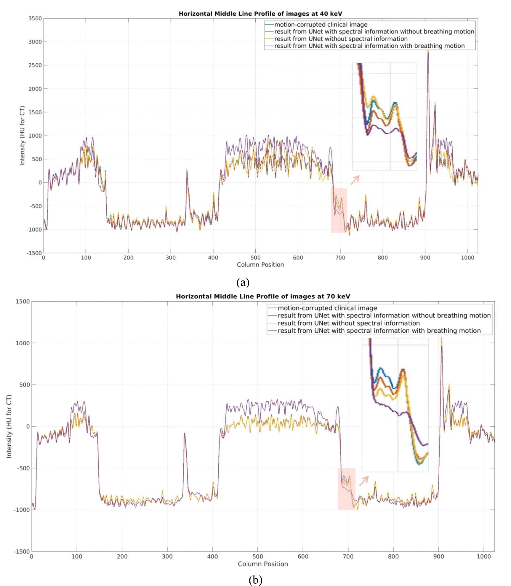 Deep-learning-based spectral motion artifact correction on photon ...