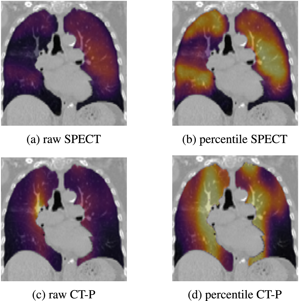 Clinical validation of perfusion imaging with pulmonary function test ...